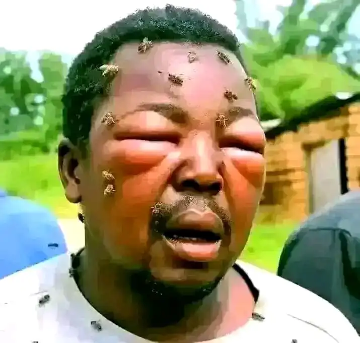 Most Wanted And Popular Nakonde Car Thief Gets Attacked By Bees After He Tried The Wrong Person, See Details