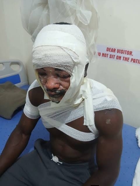 Zambia : Mazabuka Man Dies In Hot Water Attack